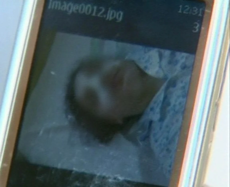 
    Tatăl a arătat fotografii cu fiica lui, după operaţie (Foto: captură video Pro TV)  