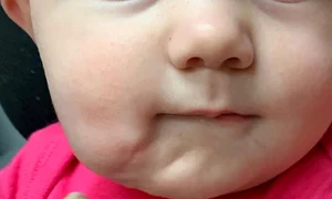 Așa arată bebelușul după ce a fost operat  jpeg