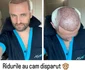 Sorin Brotnei a făcut cel de-al doilea transplant de păr foto: Instagram