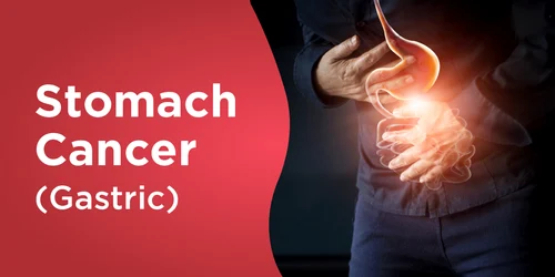 Cancerul gastric reprezintă a cincea formă de tumoare la nivel mondial Foto Regency Healthcare jpg