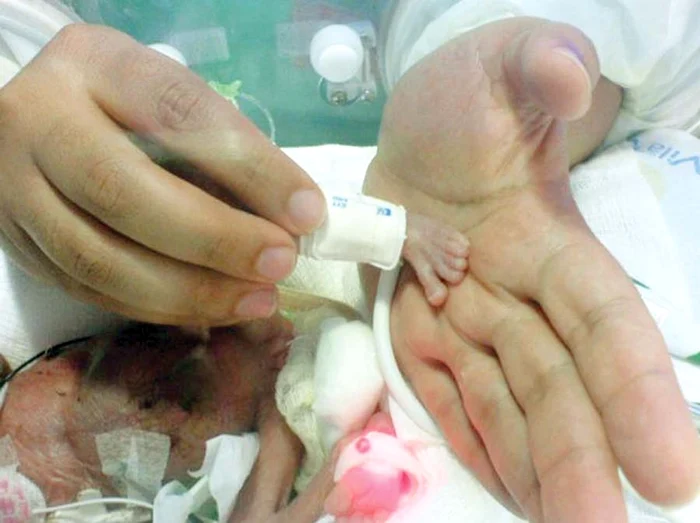 
    Picioruşul Carolinei nu e mai mare  decât un deget al unui adult  