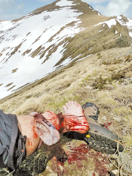 Piciorul drept al tânărului german, sfâşiat de fiară