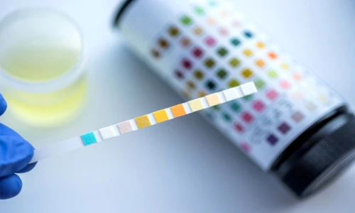 analize boli de rinichi jpeg