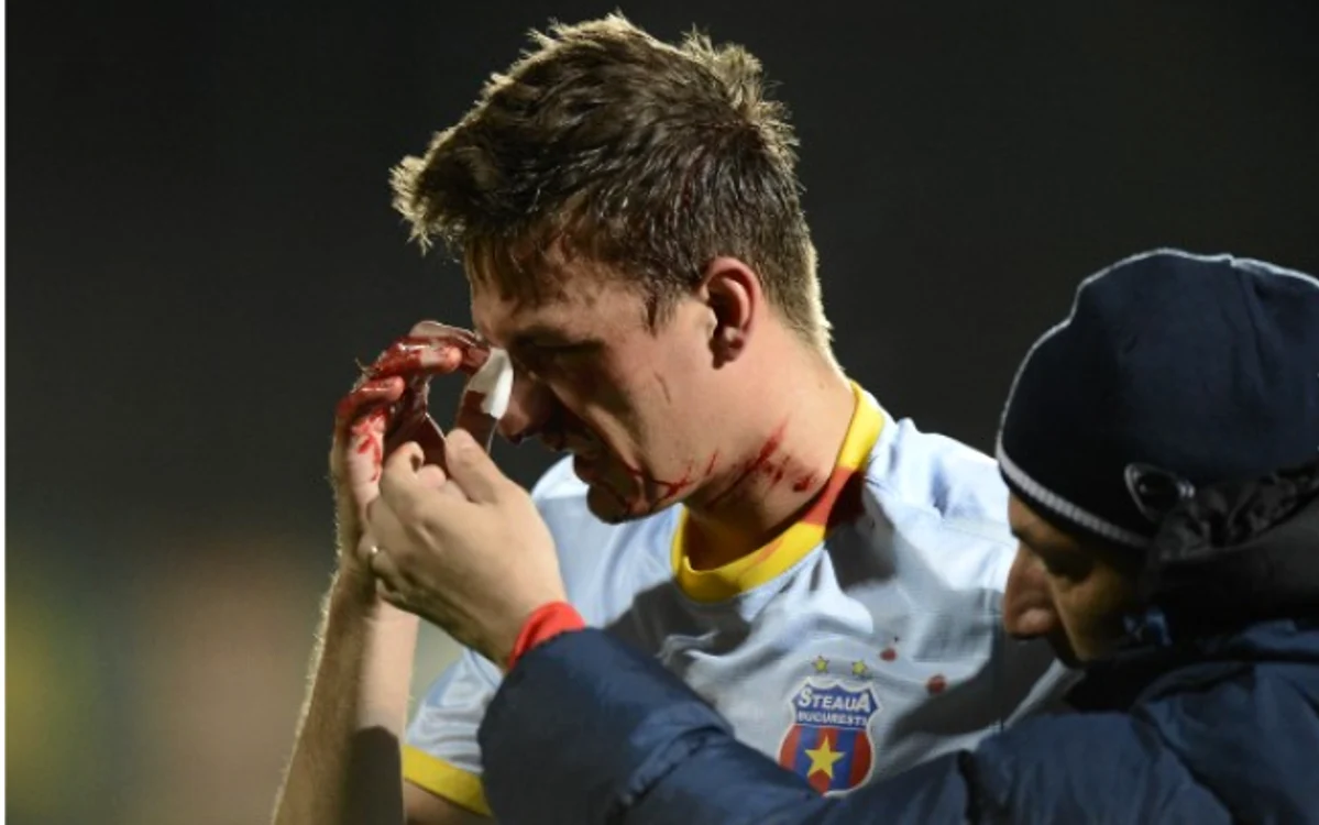 Lukas Szukala, plin de sânge după ce a primit un cot în faţă de la un adversar FOTO gsp.ro