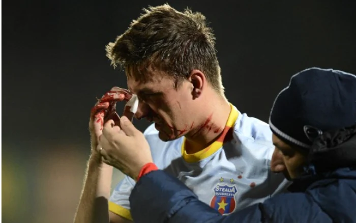 Lukas Szukala, plin de sânge după ce a primit un cot în faţă de la un adversar FOTO gsp.ro