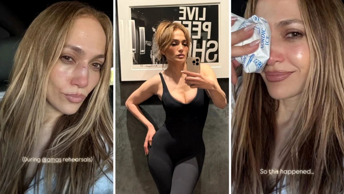 Jennifer Lopez și cicatricea rămasă pe chip