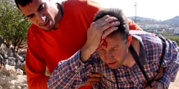 Terapia prin alcool ar putea ajuta persoanele care au suferit răni la cap