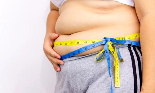 operatie obezitate jpg