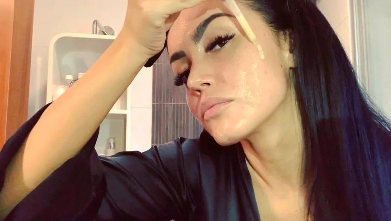 
    Andreea Mantea se tratează de acneea care i-a revenit de două săptămâniFoto: Facebook  