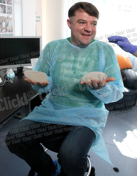 andrei duban interventie implant