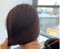 Ilinca Vandici a testat botoxul pentru trapez la doctor Iancu Morad foto: Instagram