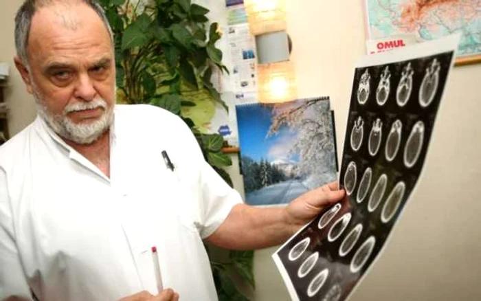 Craiova: Medicul Cameniţă arată tomografia făcută politistului.