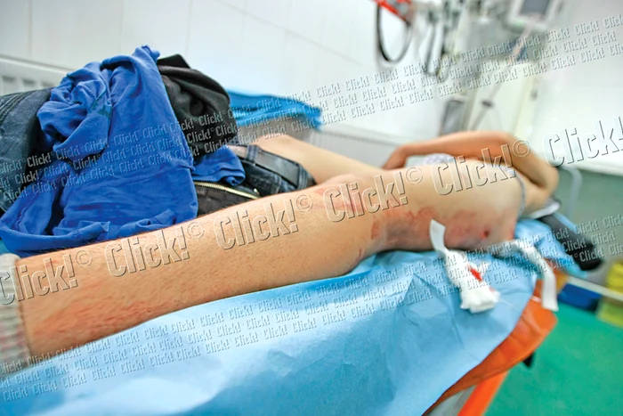 Elevii au fost înjunghiaţi în picior