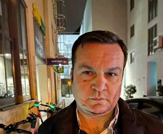 Cherecheş s-a ales cu răni ușoare după ce s-a opus arestării. FOTO Facebook/ Sindicatul Europol