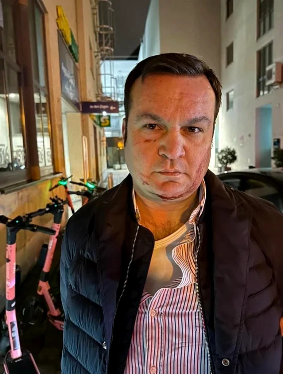 Cătălin Cherecheş s-a ales cu răni ușoare după ce s-a opus arestării - Facebook/ Sindicatul Europol