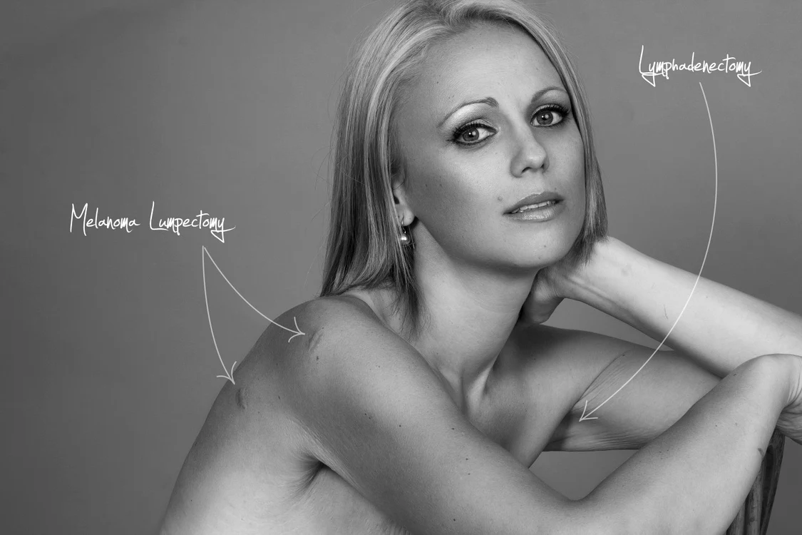Beth Whaanga a apelat la mastectomie, histerectomie totală, limfadectomie şi lumpectomie pentru a preveni cancerul. FOTO The Huffington Post