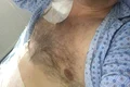 Gogoașe, zâmbet și mesaj optimist de pe patul de spital jpeg