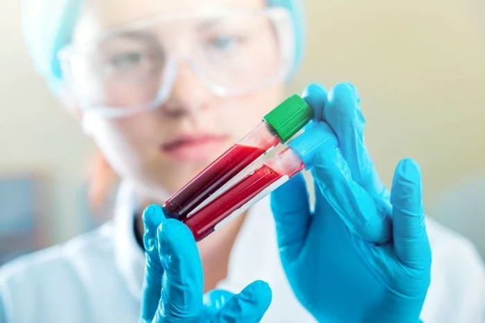 1 hemofilie jpg jpeg