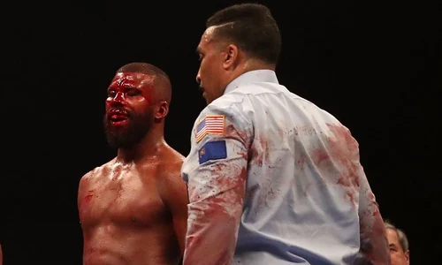 badou jack frunte taiata las vegas jpeg