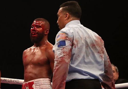Badou Jack a boxat cu fruntea spartaFOTO: Guliver/ Gettyimages