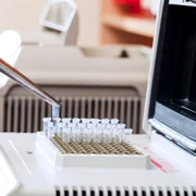 in vitro