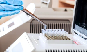 in vitro