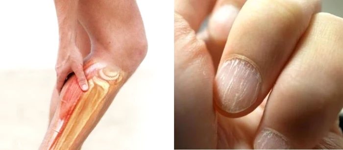 1 ai acnee ti se rup ungiile iti cade parul si ai dureri de stomac si de cap uite ce deficiente uriase ai in corp 47dn jpg jpeg