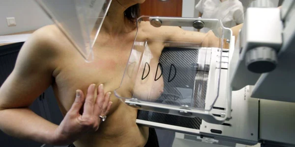 Examinarea radiologică a sânului prin mamografie