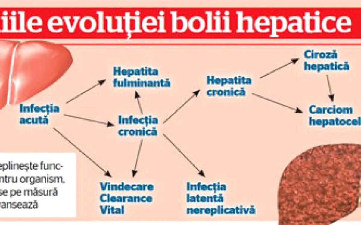 Hepatita