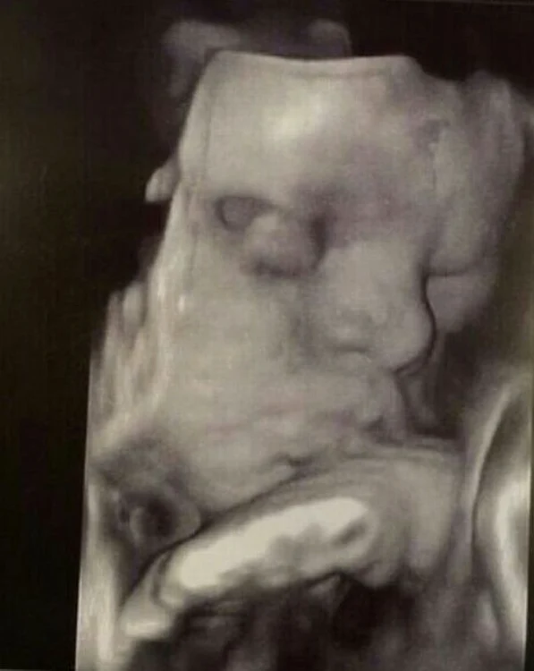 Roxana a fost foarte emoţionată când i-a văzut chipul fetiţei la ecografie