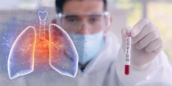 coronavirus plamani test sange eprubeta foto shutterstock