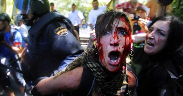 La Voz Libre | Imaginea femeii rănite în timpul protestelor de la Madrid estet reprezentativă pentru „Marșul Negru” al minerilor
