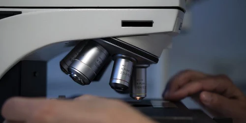 hemoragiile oculte pot fi vazute al microscop foto pixabay jpg