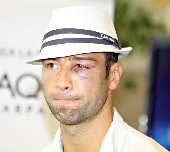 Bute vrea o lună de vacanţă (foto: lexar)