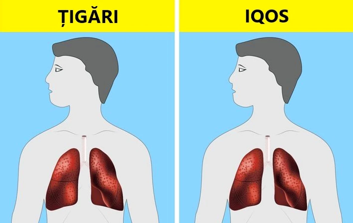 Cinci tendinţe în sănătate care îţi pun viaţa în pericol jpeg