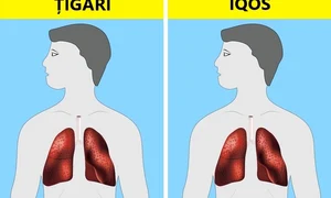 Cinci tendinţe în sănătate care îţi pun viaţa în pericol jpeg