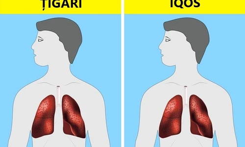 Cinci tendinţe în sănătate care îţi pun viaţa în pericol jpeg