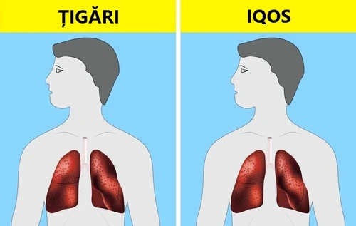 Cinci tendinţe în sănătate care îţi pun viaţa în pericol jpeg