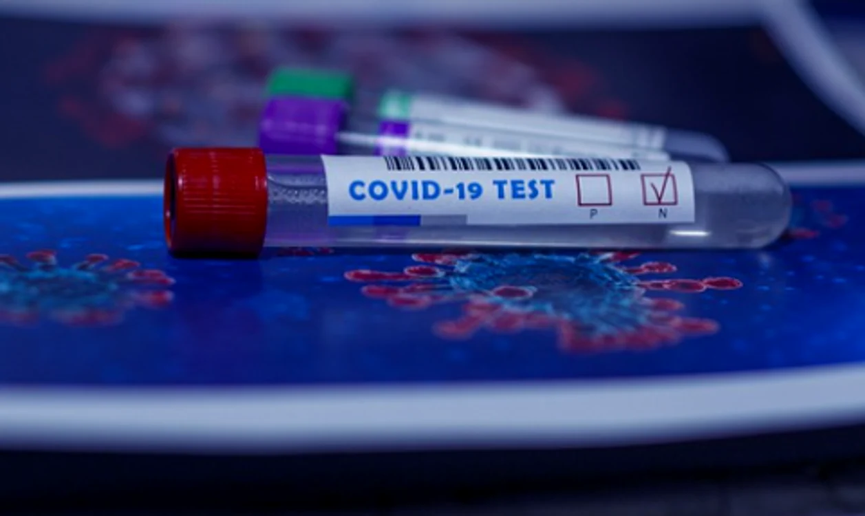 Peste 500 de persoane au fost diagnosticate cu COVID-19 în 24 de ore / Foto: Arhivă