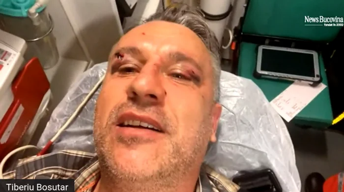 Activistul de mediu Tiberiu Boșutar spune că îi știe pe agresori, dar se teme să-i numeascăfoto: captură video/News Bucovina