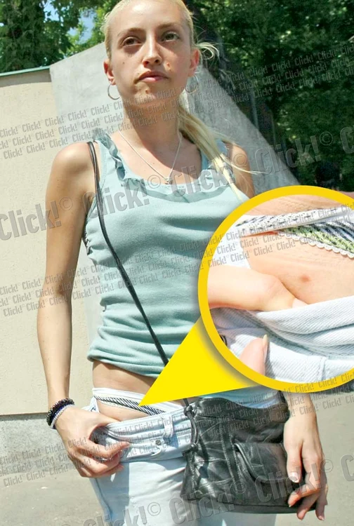 Andreea Băeşu ne arată locul în care a fost înţepată de căpuşă