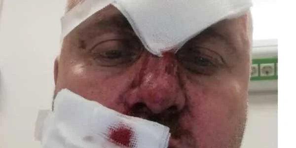 Bogdan Costinescu - Pătrăţel - fost consilier local - susţine că a fost victima răzbunării primarului din Râmnicu Vâlcea - Mircia Gutău Foto Facebook