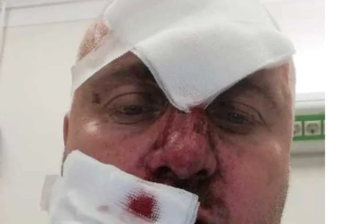 Bogdan Costinescu, fost consilier local, susţine că a fost victima răzbunării primarului din Râmnicu Vâlcea, Mircia Gutău Foto Facebook