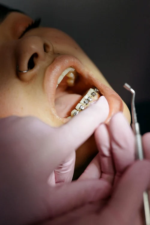Cum afectează dinții întregul organism Sursa foto: Pexels