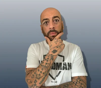 CRBL, primele poze după blefaroplastie foto: Instagram 