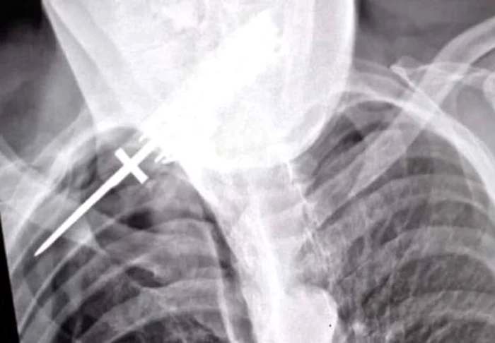 Radiografia realizată la spitalul din Suceava FOTO Dănuţ Zuzeac