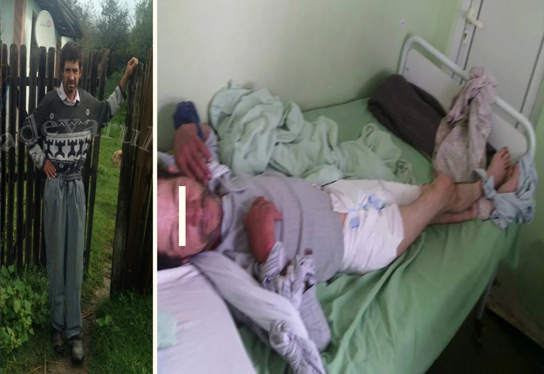 Imagini cu pacientul respectiv la Spitalul Judeţean Slatina