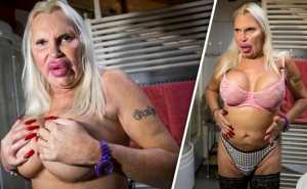 Transexualul încearcă să obţină un trup perfect de femeie, iar pentru a avea un posterior apetisant nu a ezitat să plătească 12.000 de euro. FOTO Daily Star