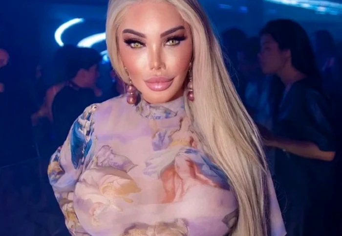 Jessica
Alves, fostul Rodrigo Alves, după operaţia de schimbare de sex. Foto: Instagram