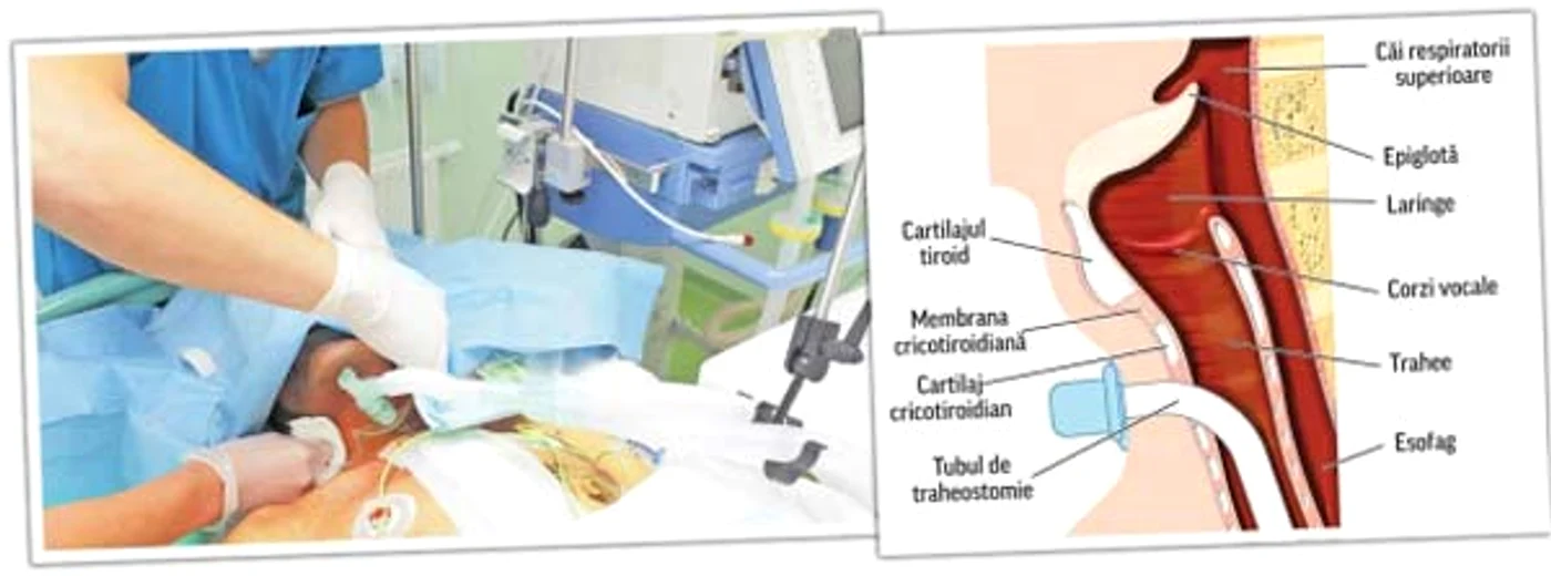 Iată ce i-au făcut medicii cântăreţului